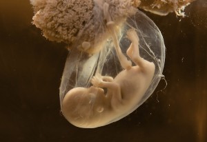 Unborn human embryo model for education purpose